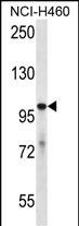 USP6 Antibody (E978) (Cat. #AP2135b) western blot analysis in NCI-H460 cell line lysates (35ug/lane).This demonstrates the USP6 antibody detected the USP6 protein (arrow).