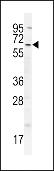 WB - cIAP2 (BIRC3) Antibody (N-term) AP6124a