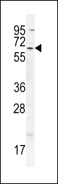 BIRC3 Antibody (S116) (Cat. #AP6124a) western blot analysis in A549 cell line lysates (35ug/lane).This demonstrates the BIRC3 antibody detected the BIRC3 protein (arrow).