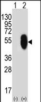 Western blot analysis of MLLT6 (arrow) using rabbit polyclonal MLLT6 Antibody (E1071) (Cat. #AP6192a). 293 cell lysates (2 ug/lane) either nontransfected (Lane 1) or transiently transfected (Lane 2) with the MLLT6 gene.