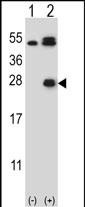 Western blot analysis of KLK6 (arrow) using rabbit polyclonal KLK6 Antibody (L141) (Cat. #AP6325b). 293 cell lysates (2 ug/lane) either nontransfected (Lane 1) or transiently transfected (Lane 2) with the KLK6 gene.