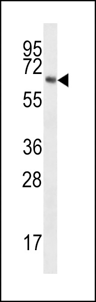 TPTEa Antibody (E57) (Cat. #AP6811a) western blot analysis in MDA-MB231 cell line lysates (35ug/lane).This demonstrates the TPTEa antibody detected the TPTEa protein (arrow).