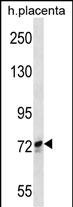 SCYL1 Antibody (N-term) (Cat. #AP7215a) western blot analysis in human placenta tissue lysates (35ug/lane).This demonstrates the SCYL1 antibody detected the SCYL1 protein (arrow).