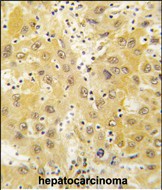 IHC-P - Tiparp  Antibody (N-term) AP7978a