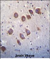 IHC-P - DGKQ Antibody (C-term) AP8122b