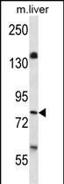 KIAA1811 Antibody (S685) (Cat. #AP8168b) western blot analysis in mouse liver tissue lysates (35ug/lane).This demonstrates the KIAA1811 antibody detected the KIAA1811 protein (arrow).