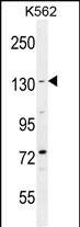 BAI1 Antibody (Q1552) (Cat. #AP8170a) western blot analysis in K562 cell line lysates (35ug/lane).This demonstrates the BAI1 antibody detected the BAI1 protein (arrow).