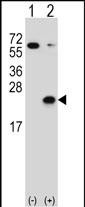 Western blot analysis of DUSP3 (arrow) using rabbit polyclonal DUSP3 Antibody (C171) (Cat. #AP8446a). 293 cell lysates (2 ug/lane) either nontransfected (Lane 1) or transiently transfected (Lane 2) with the DUSP3 gene.