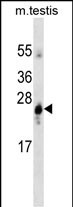 GSTA1 (Cat. #AM1932a) western blot analysis in mouse testis tissue lysates (35?g/lane).This demonstrates the GSTA1 antibody detected the GSTA1 protein (arrow).