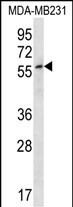 WB - ZNF506 Antibody (N-term) AP12770A