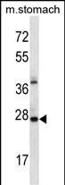 WB - ALKBH4 Antibody (Center) AP12774C