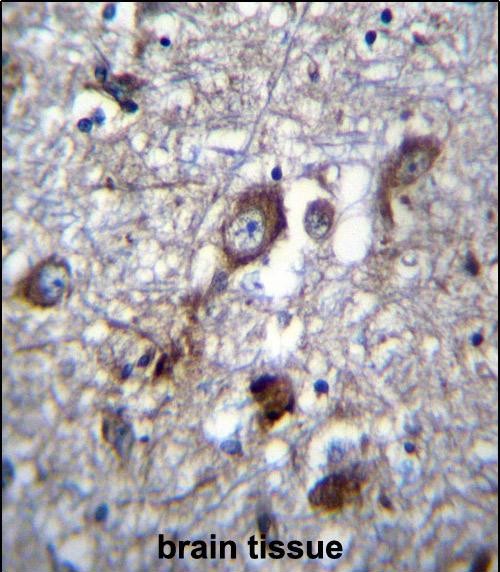 IHC-P - PLEKHH1 Antibody (C-term) AP12777b