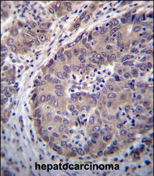 IHC-P - PNLIPRP3 Antibody (N-term) AP12784a