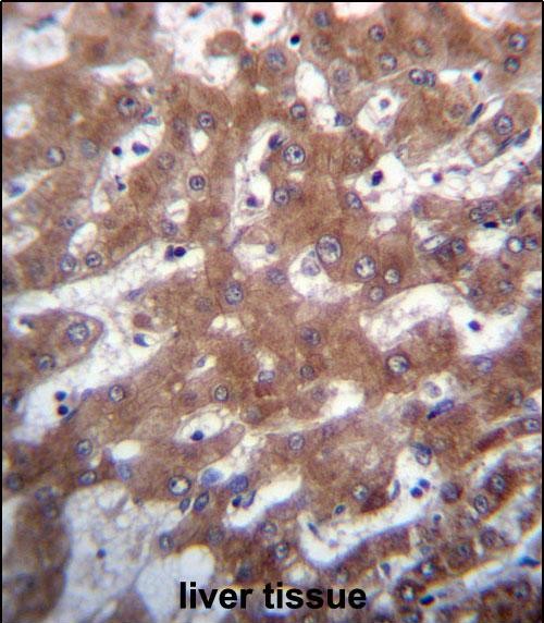 IHC-P - TRUB1 Antibody (Center) AP12789c