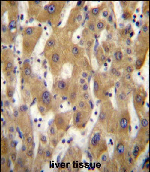 IHC-P - PAGE5 Antibody (C-term) AP12792b