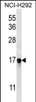 WB - PAGE5 Antibody (C-term) AP12792b
