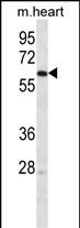 WB - LINGO4 Antibody (C-term) AP12795b