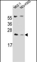 WB - LIN7C Antibody (C-term) AP12807b