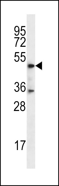 WB - DSN1 Antibody (C-term) AP12820b