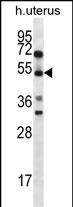 ABRA Antibody (C-term) (Cat. #AP12828b) western blot analysis in human normal Uterus tissue lysates (35ug/lane).This demonstrates the ABRA antibody detected the ABRA protein (arrow).