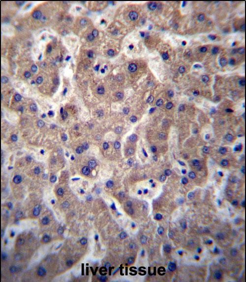 IHC-P - SULT1A3/SULT1A4 Antibody (N-term) AP12849a