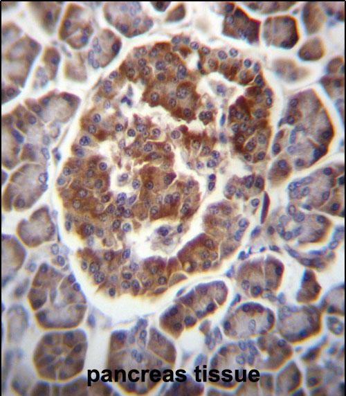 IHC-P - TBC1D22A Antibody (C-term) AP12853B