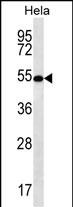 SCHIP1 Antibody (Center) (Cat. #AP12855c) western blot analysis in Hela cell line lysates (35ug/lane).This demonstrates the SCHIP1 antibody detected the SCHIP1 protein (arrow).