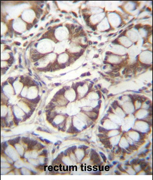 IHC-P - LAD1 Antibody (N-term) AP12860a