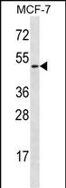 WB - LAD1 Antibody (N-term) AP12860a