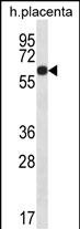 WB - GLCCI1 Antibody (Center) AP12862c