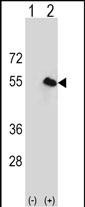 Western blot analysis of CPN1 (arrow) using rabbit polyclonal CPN1 Antibody (Center) (Cat. #AP12882c). 293 cell lysates (2 ug/lane) either nontransfected (Lane 1) or transiently transfected (Lane 2) with the CPN1 gene.