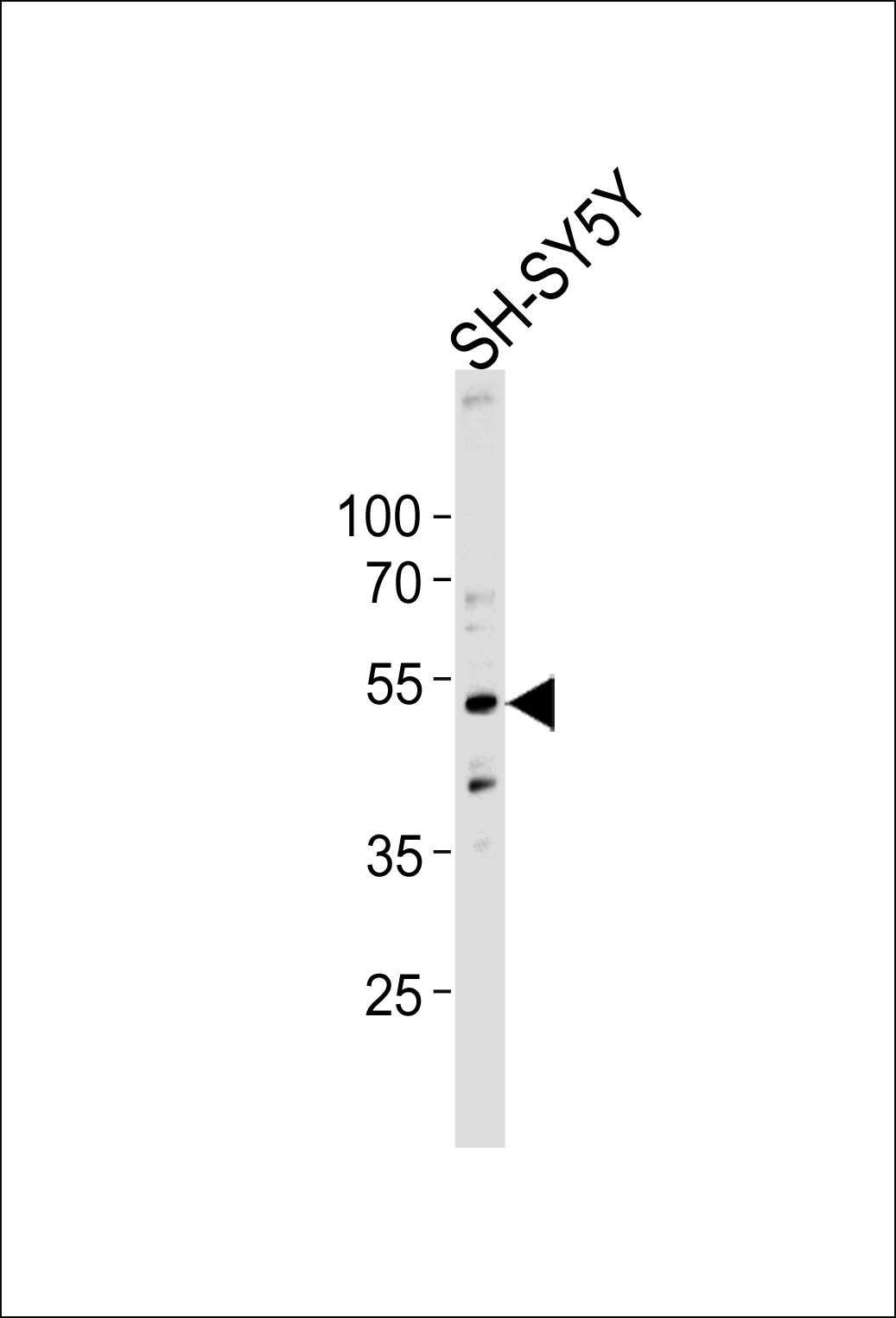 Western blot analysis of lysate from SH-SY5Y cell line, using DCTN2 Antibody (Center)(Cat. #AP12893c). AP12893c was diluted at 1:1000 at each lane. A goat anti-rabbit IgG H&L(HRP) at 1:5000 dilution was used as the secondary antibody. Lysate at 35ug per lane. 