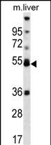 PPARA Antibody (Center) (Cat. #AP12910c) western blot analysis in mouse liver tissue lysates (35ug/lane).This demonstrates the PPARA antibody detected the PPARA protein (arrow).
