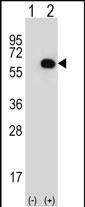 Western blot analysis of GK (arrow) using rabbit polyclonal GK Antibody (N-term) (Cat. #AP12927a). 293 cell lysates (2 ug/lane) either nontransfected (Lane 1) or transiently transfected (Lane 2) with the GK gene.