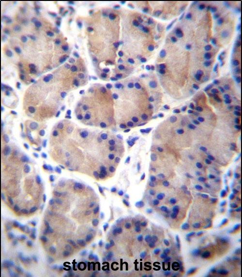 IHC-P - CES8 Antibody (C-term) AP12964b