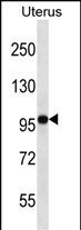 FGD4 Antibody (N-term) (Cat. #AP12983a) western blot analysis in human normal Uterus tissue lysates (35ug/lane).This demonstrates the FGD4 antibody detected the FGD4 protein (arrow).