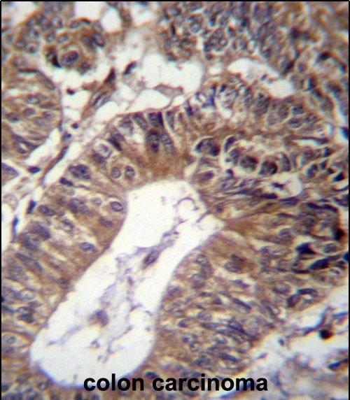 IHC-P - GCC1 Antibody (C-term) AP12984B