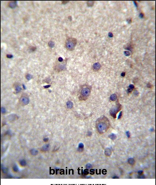 IHC-P - HBQ1 Antibody (N-term) AP12996a