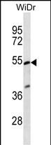 PIGV Antibody (C-term) (Cat. #AP13001b) western blot analysis in WiDr cell line lysates (35ug/lane).This demonstrates the PIGV antibody detected the PIGV protein (arrow).