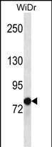 WB - LZTS2 Antibody (C-term) AP13002b