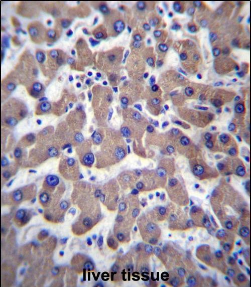 IHC-P - TMM70 Antibody (C-term) AP13011b