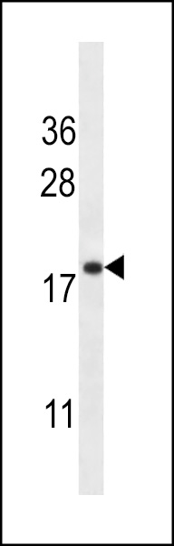 WB - TMM70 Antibody (C-term) AP13011b