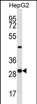 WB - PROSC Antibody (C-term) AP13026b