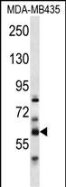 PTDSS2 Antibody (N-term) (Cat. #AP13051a) western blot analysis in MDA-MB435 cell line lysates (35ug/lane).This demonstrates the PTDSS2 antibody detected the PTDSS2 protein (arrow).
