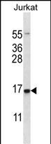 WB - DDIT3 Antibody (Center) AP13063c