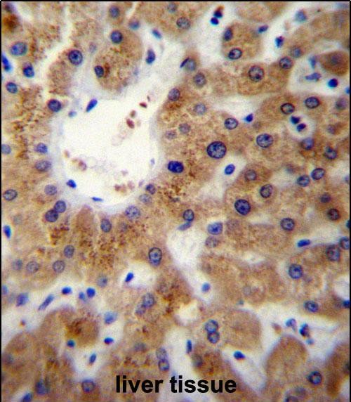 IHC-P - ERLIN1 Antibody (Center) AP13078c