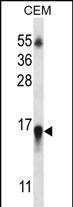 WB - HIST1H2BN Antibody (N-term) AP13115A
