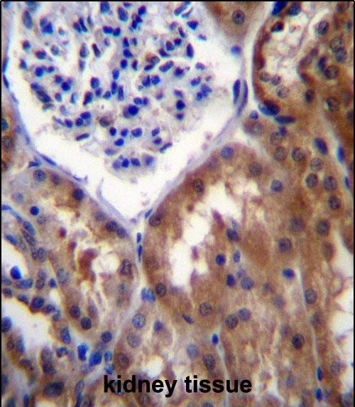 IHC-P - PR15B Antibody (C-term) AP13118b