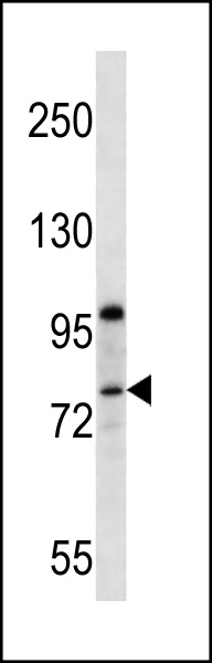WB - PR15B Antibody (C-term) AP13118b
