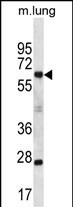 WB - SP2 Antibody (C-term) AP13121b
